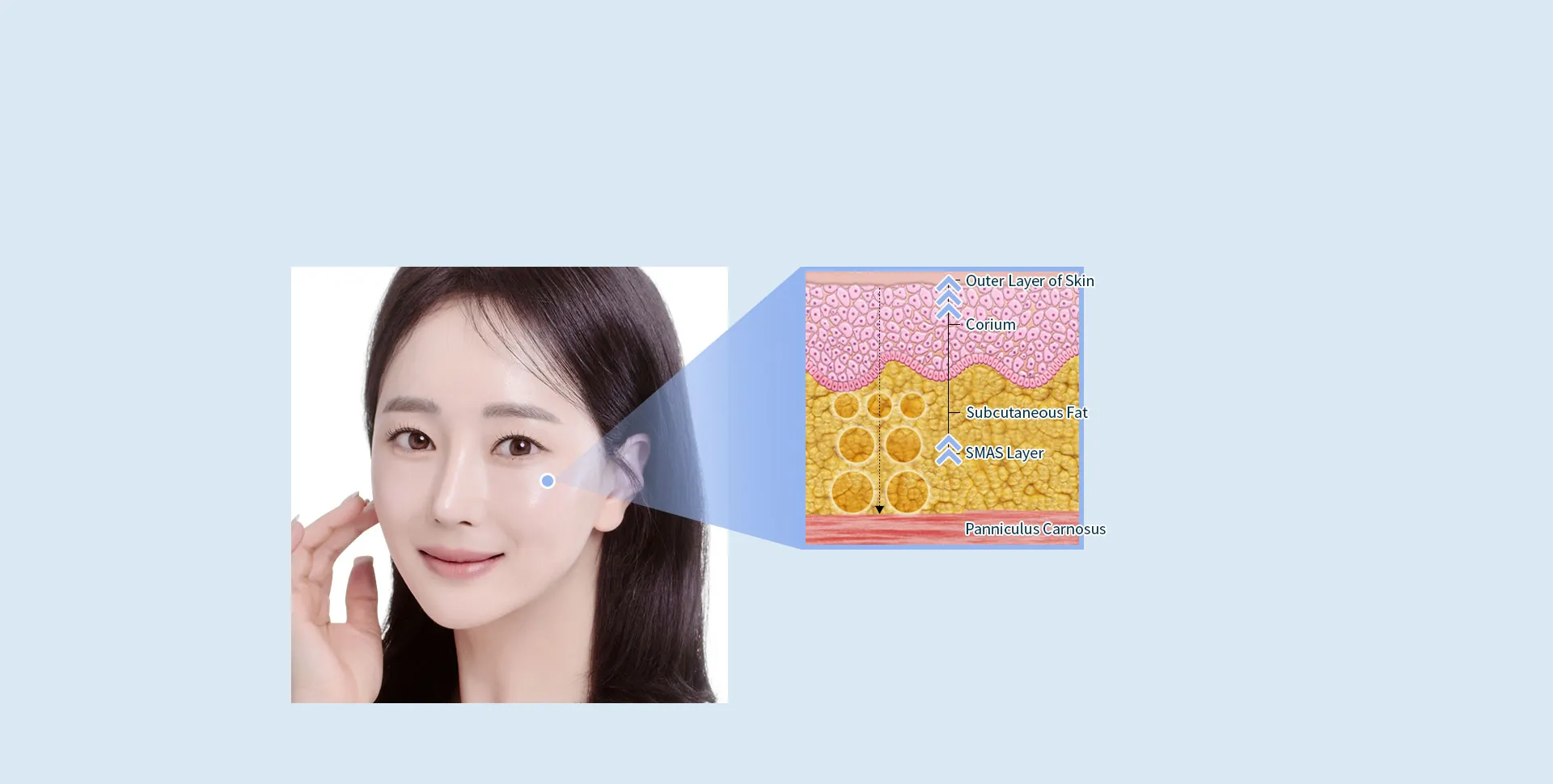 지방주입(풀페이스)