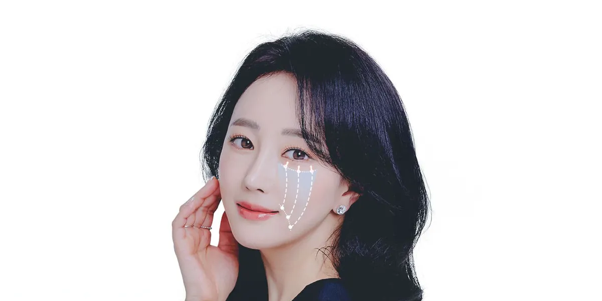 하부 안검 성형술