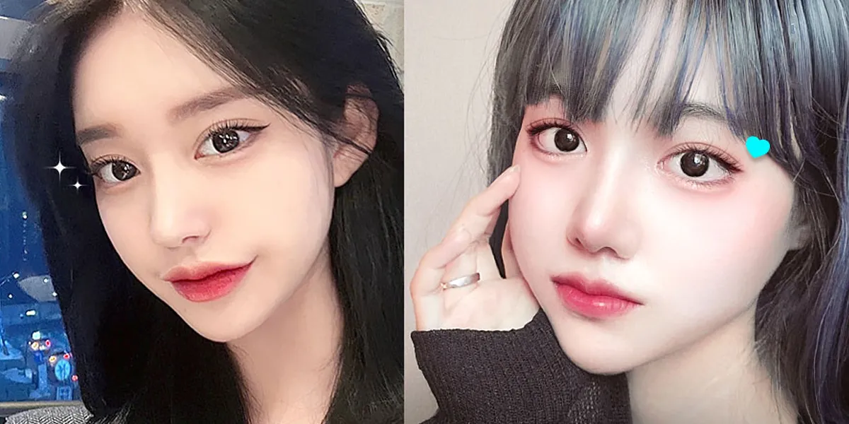 상부 안검 성형술