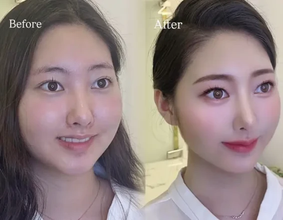 세렌뷰트 선릉점 | 조립