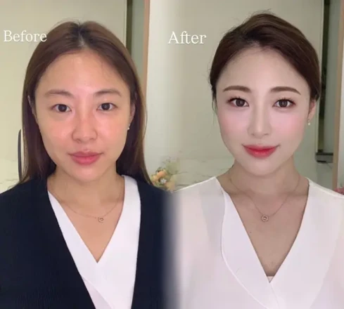 세렌뷰트 선릉점 | 조립