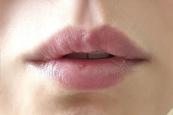 랩노 4SP 세이프 립밤