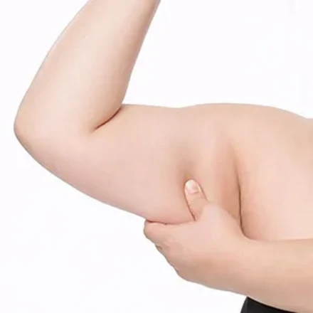 지방흡입(복부)