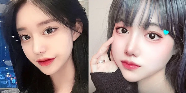 상부 안검 성형술